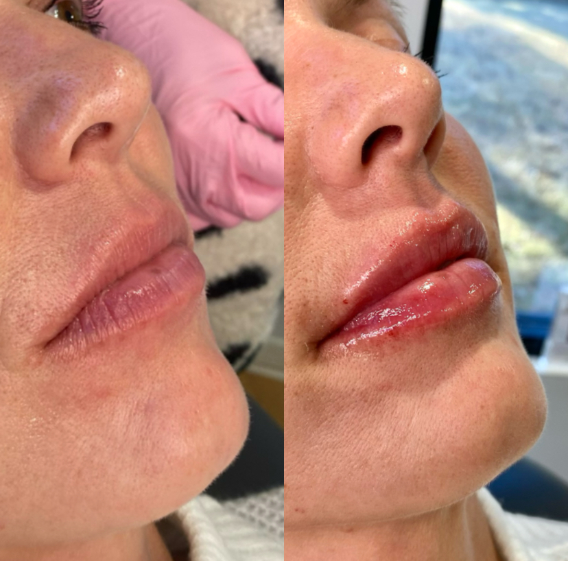 lips B&A.jpeg